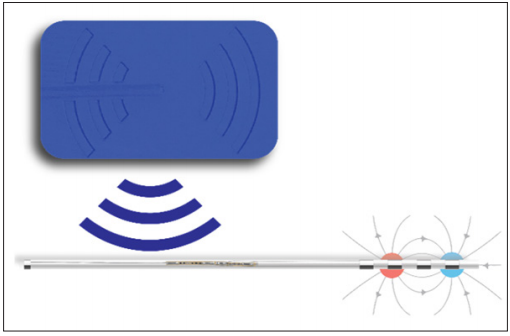 Stimwave, Peripheral Nerve Stimulation for Chronic Pain — Advanced