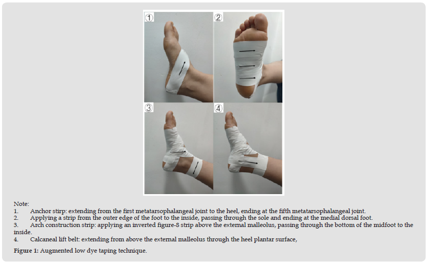 Acute Effects of Athletic Taping Techniques on Calcaneus Frontal Motion ...