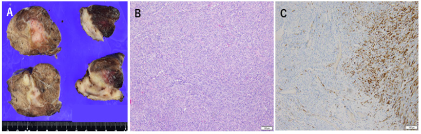 Click here to view Large Figure 2 biomedres-openaccess-journal-bjstr