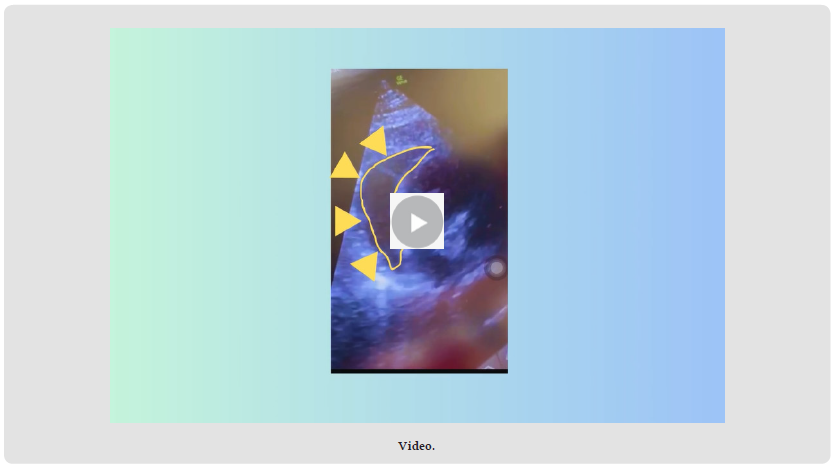 biomedres-openaccess-journal-bjstr